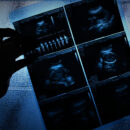 Imprescindible, erradicar cifra negra de mujeres que mueren en abortos clandestinos