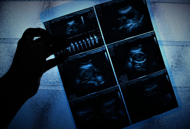 Imprescindible, erradicar cifra negra de mujeres que mueren en abortos clandestinos