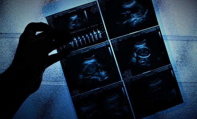 Imprescindible, erradicar cifra negra de mujeres que mueren en abortos clandestinos