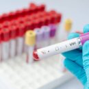 Blood sample positive with hi