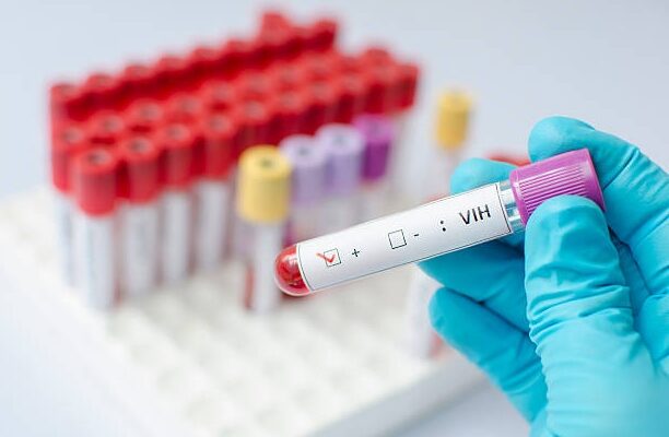 Blood sample positive with hi