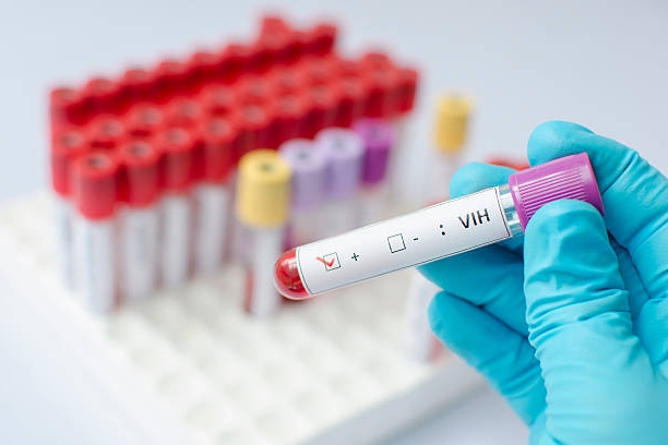 Blood Sample Positive With Hi